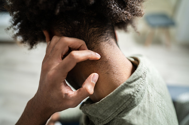 Why Does Your Scalp Itch So Bad?