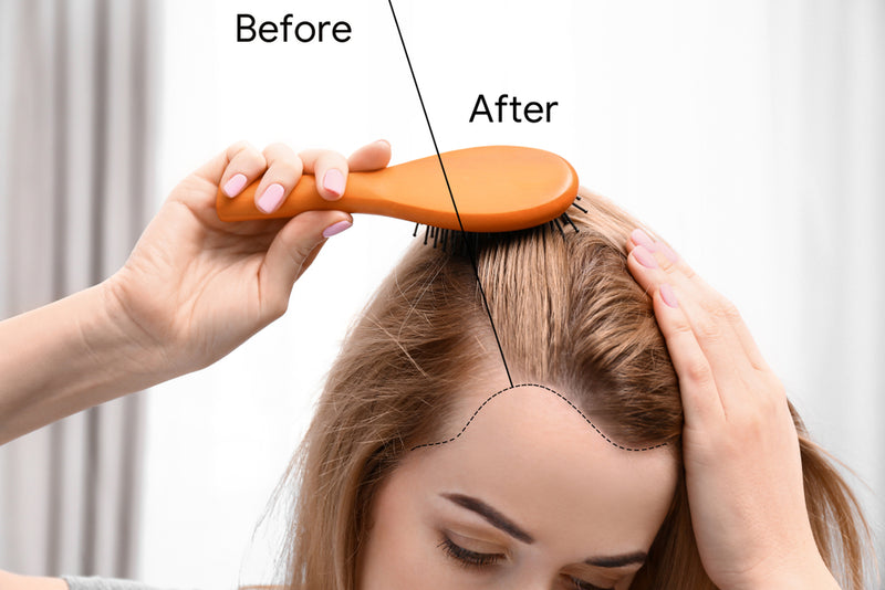 What Are Trace Minerals & Why Are They Important for Your Hair Growth?