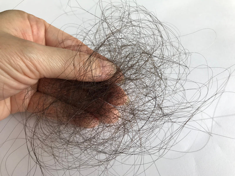 Is Low Potassium Causing Your Hair Loss?