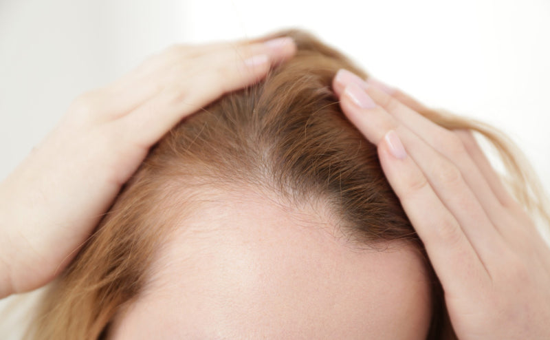 Traction Alopecia: When is it too late?