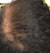 5th Client's scalp after hair growth treatment
