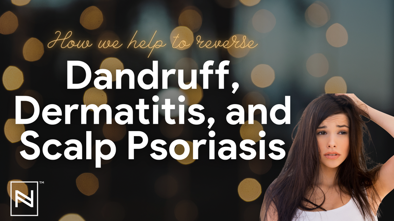 Dandruff, Dermatitis, and Scalp Psoriasis