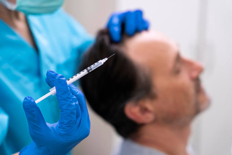 PRP for Hair Loss: Is It Worth the Hype?