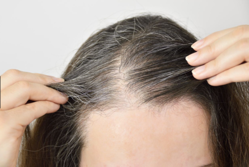 How to Reverse Telogen Effluvium & Grow Back Your Hair