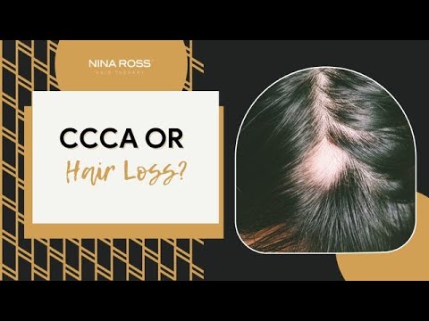 CCCA or Hair Loss?