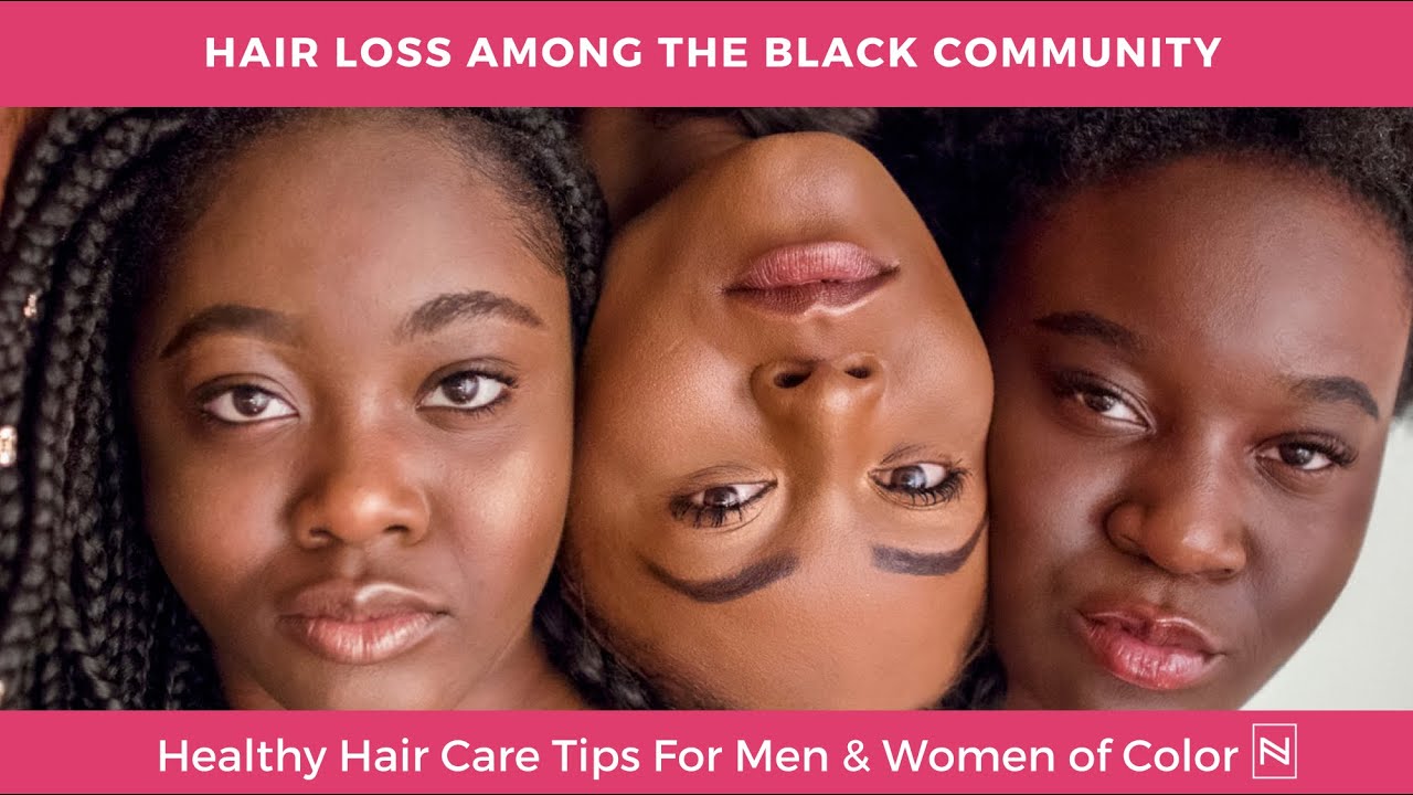 Hair Loss in Black Women | Hair Loss Treatment for Women | Hair Loss Women