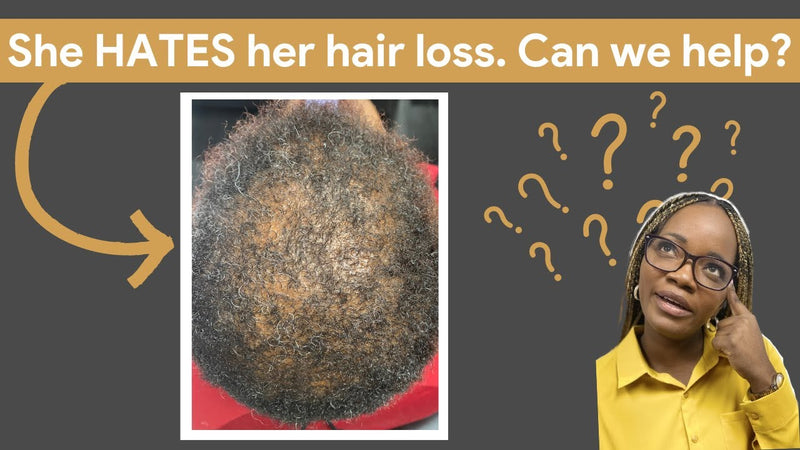 She HATED her scalp condition. Until... [CCCA Transformation Story]