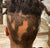 Alopecia Areata Client's hair before treatment